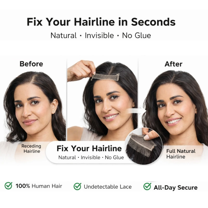 Instantly Fix Your Hairline — No One Will Ever Know💁‍♀️💖